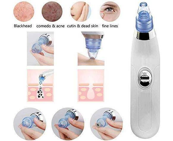 4 In 1 Black Head, acne, Pimple, Pore Remover Machine