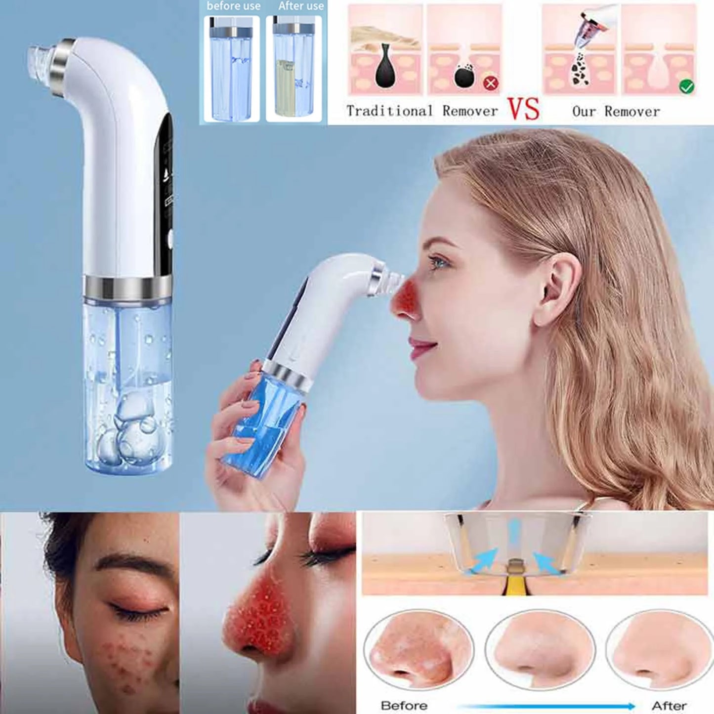 Deep Pore Cleanser for Acne, Oil & Blemishes | Bubble Technology