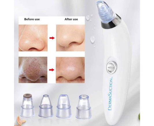4 In 1 Black Head, acne, Pimple, Pore Remover Machine