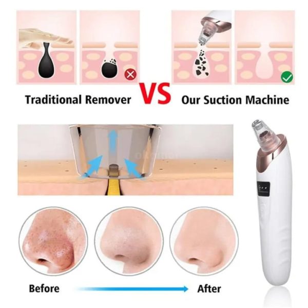 Electric Deep Cleansing Tool For Nose &amp; Face