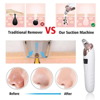 Electric Deep Cleansing Tool For Nose &amp; Face